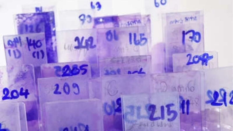 tính xác suất trúng lô đề hôm nay